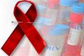 تحذيرات بالغة من انتشار الإيدز بمصر