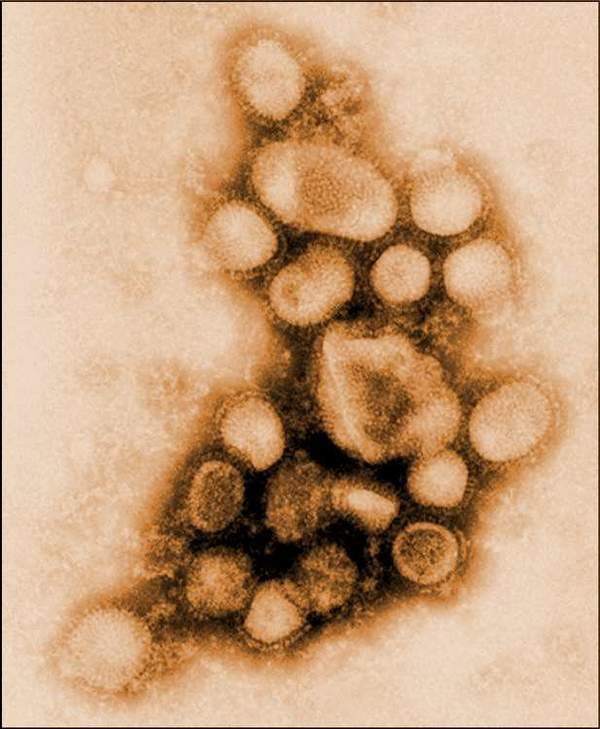 أول صورة لفيروس أنفلونزا الخنازير