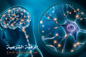 رقية لعلاج تلف خلايا المخ والدماغ الميتة بإذن الله - الشيخ ابو آيه
