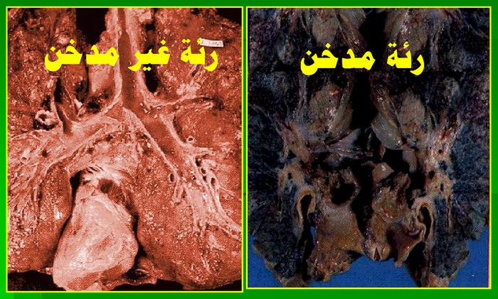 صورة الأعشاب