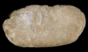 صورة الأعشاب