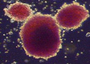 قطر تخزن الخلايا الجذعية للمواليد