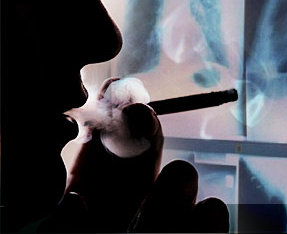 تضاعف إصابة المدخنات بسرطان الرئة 
