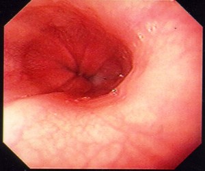 صورة الأعشاب