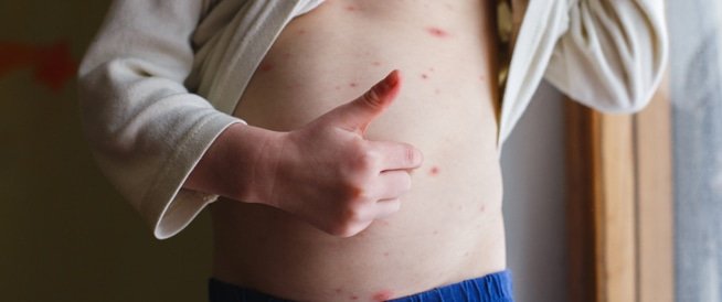 صورة الأعشاب