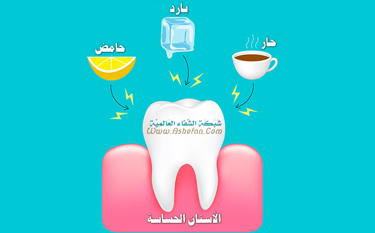 علاج لمعان الاسنان من الأطعمة والمشروبات الباردة والحارة